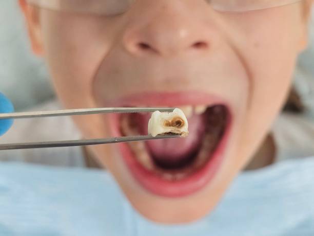 Best Orthodontic Emergency Dentist in Carterville, MO