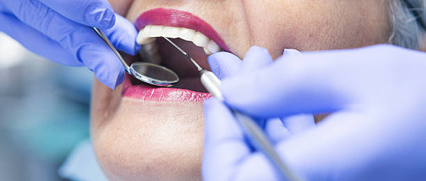 Best Weekend Emergency Dentist in Carterville, MO